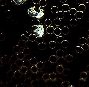 Dunkelfeld-Mikroskopie Dunkelfeld-Mikroskopie