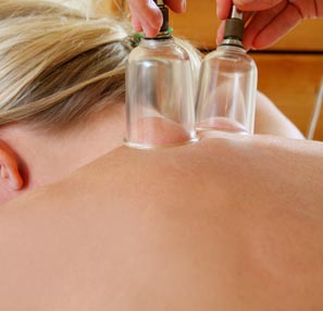 Schröpfen unblutig Schröpfen unblutig